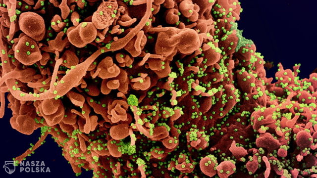 Biolog: Z obecnych wariantów SARS-CoV-2 może zostać tylko wariant delta