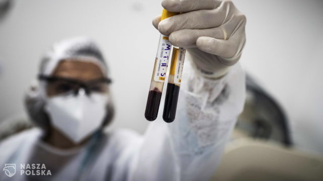 WHO: HIV zwiększa ryzyko ciężkiego przebiegu Covid-19