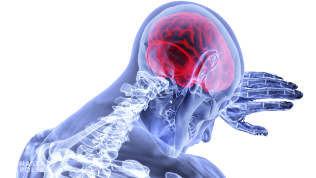 Zaburzenia neurologiczne coraz częściej dotykają Polaków. Rośnie wyzwanie dla systemu opieki społecznej i zdrowotnej