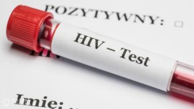 HIV: w Polsce występują niepokojące trendy